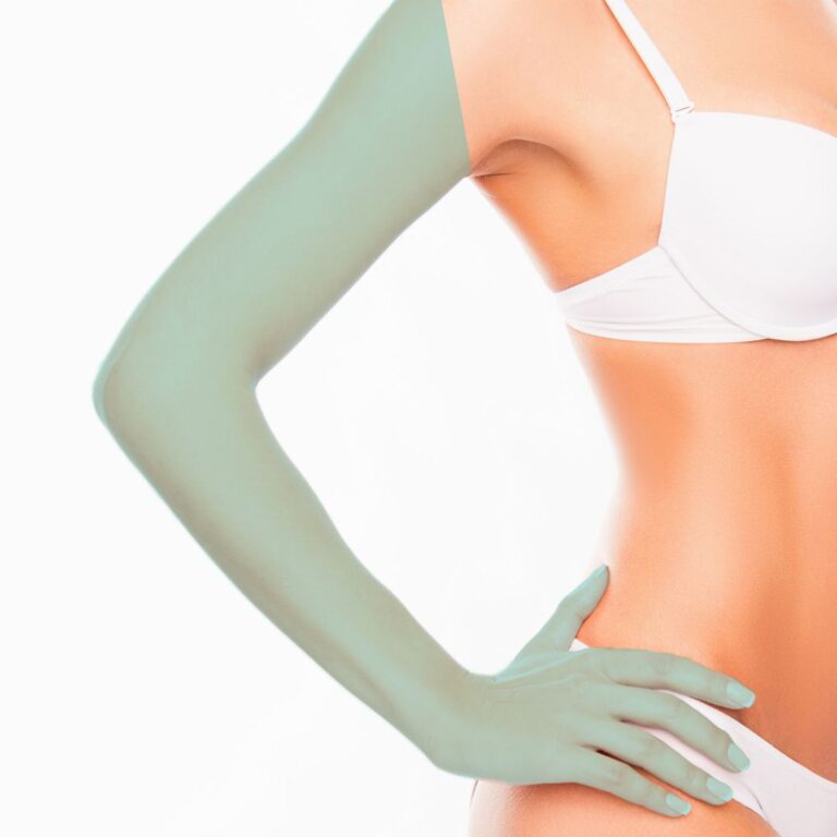 ArmsLaserHairRemoval