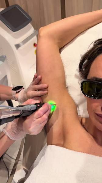laser hair removal in skin aeshetics