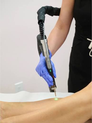 How to Prepare for Laser Hair Removal