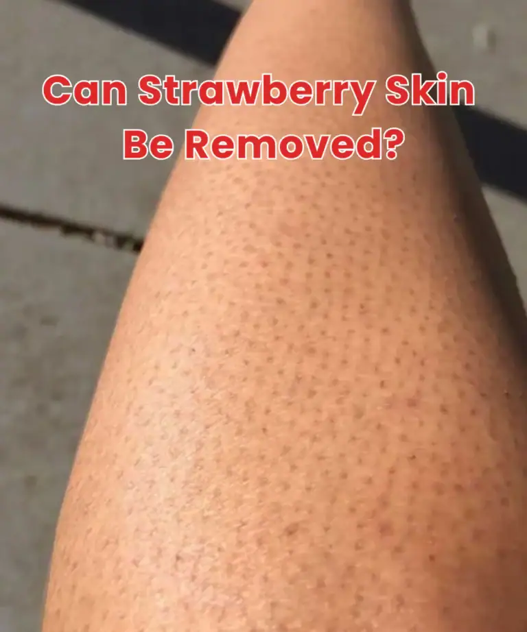 Dark dots around hair follicles on a lower leg